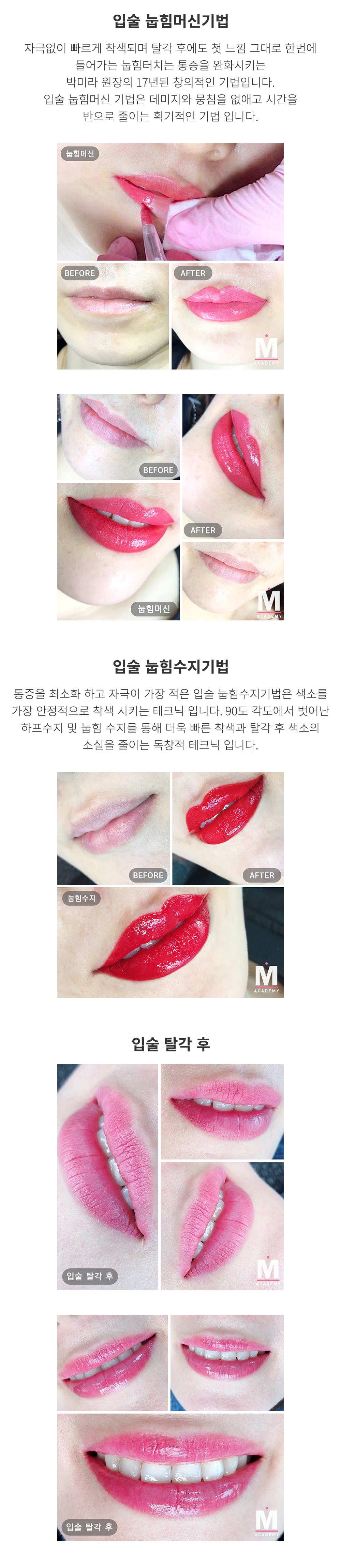 입술 눕힘머신기법